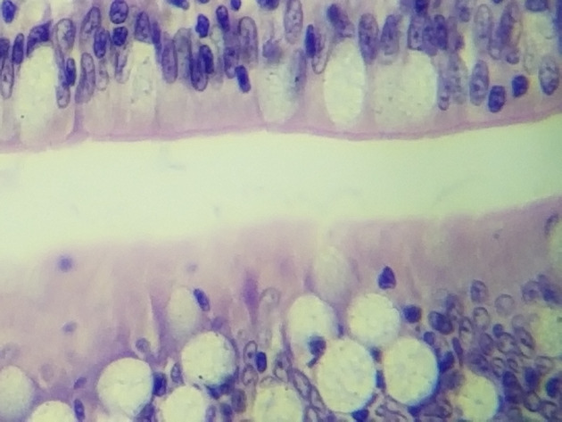 Simple Columnar Epithelium Slides - Simple Columnar Epithelium 14 400X